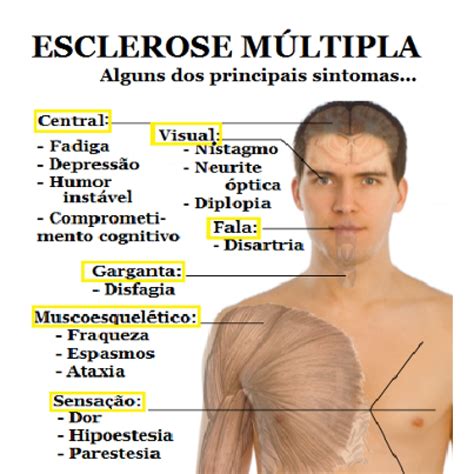 fisiopatologia da esclerose multipla|esclerose multipla sintomas iniciais.